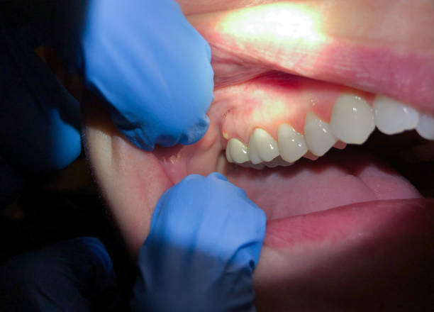 Best Cracked Tooth Emergency Dentist  in Warren, IL